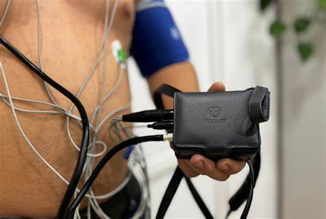 Холтер Вологда. Холтеровское мониторирование. СМАД. Холтер на сердце ...