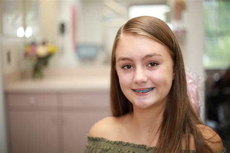 How Do Braces Straighten Teeth Central Massachusetts Orthodontics