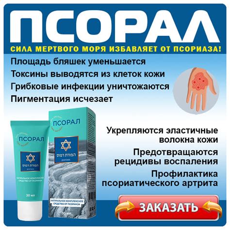 ПСОРАЛ от псориаза. ЦЕНА крема, отзывы, где купить в России?