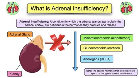 Adrenal Insufficiency Symptoms Causes Treatment Diagnosis Labs