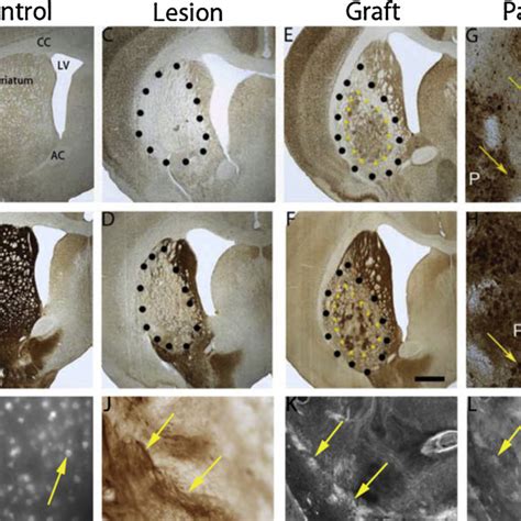 Photomicrographs of coronal sections showing representative examples of ...