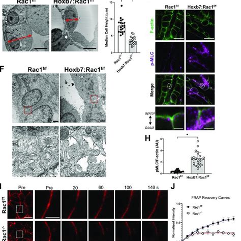 Rac1 controls lateral F-actin, actin dynamics, and lateral membrane ...