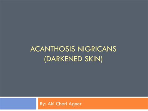 Ppt Acanthosis Nigricans Darkened Skin Powerpoint Presentation