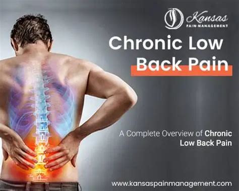 A Complete Overview of Chronic Low Back Pain