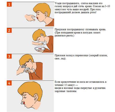 Как быстро остановить кровь из носа самостоятельно в домашних условиях