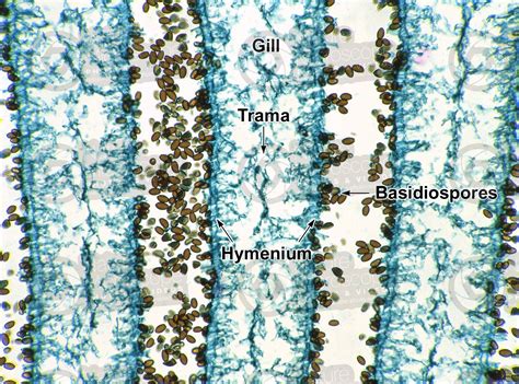 Coprinus Sp Saprophytic Fungus Gill Longitudinal Section 250x
