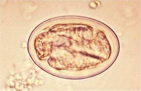 Veterinary Parasitology GI Tract Chapter 4 Flashcards Quizlet