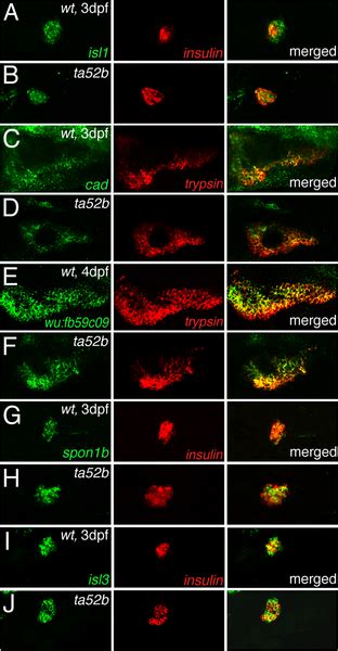 Pancreas Development Plos One