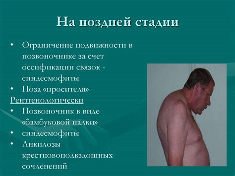 Суставной синдром - презентация онлайн