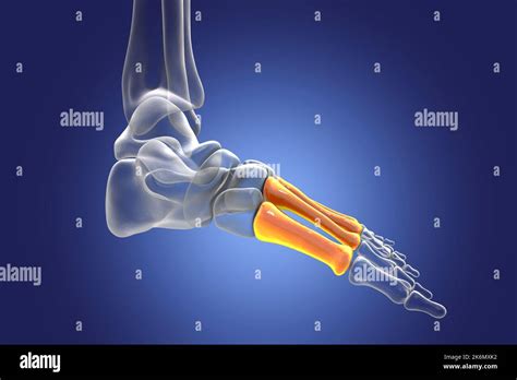 Metatarsal Bones Of The Foot Illustration Stock Photo Alamy