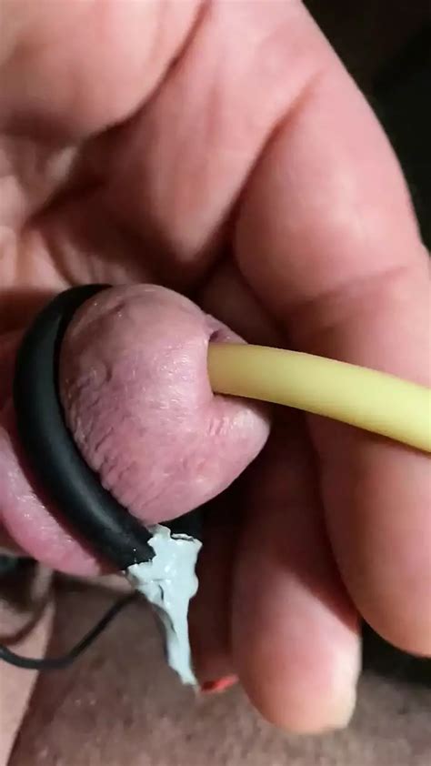 Electrocum Around Fr Catheter Gay Porn F Xhamster