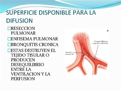 Fisiologia Respiratoria Etapas Mecanicas De La Respiracion Ventilacion