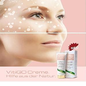 VitiGO Creme - 2 Stück Cream für Vitiligo und weißen Flecken ...