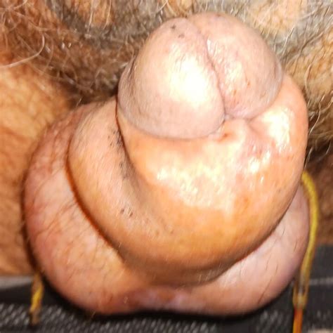 Catheter In Bladder Gay Amateur Amateur Porn Feat Johnnie D XHamster