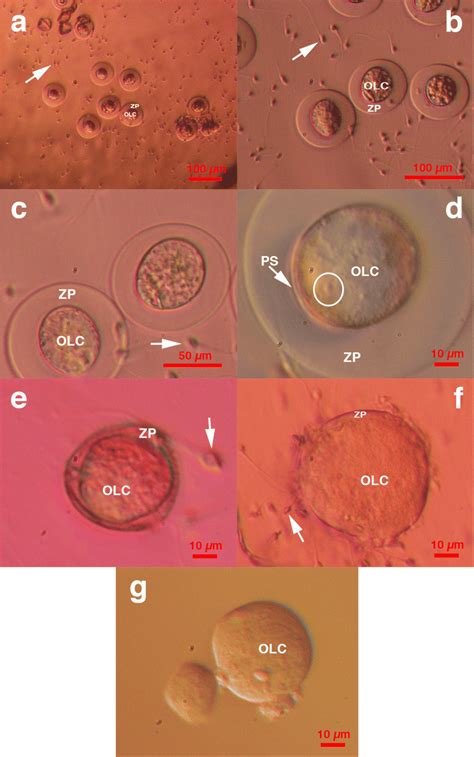 Primitive Oocyte Like Cells With Released Zona Pellucida Like