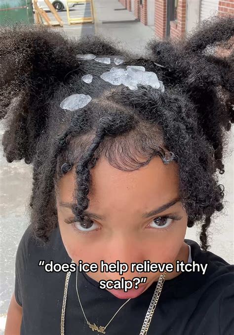 Ice Remedies for Itchy Scalp Relief | TikTok