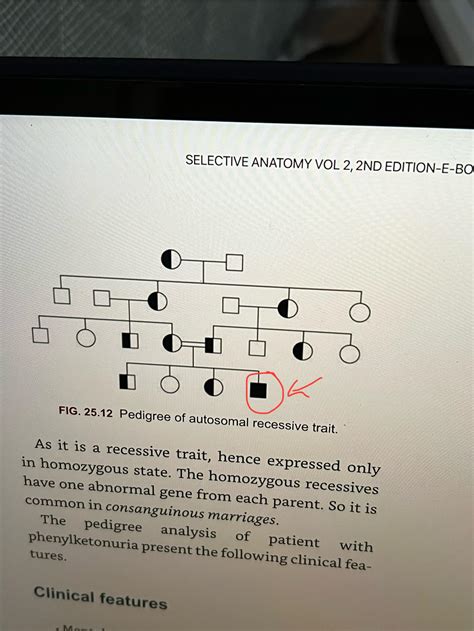 Thats What Happens When Cousins Fuck Lol R Megadeth