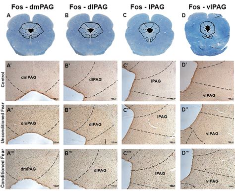 Columns Of Periaqueductal Gray Matter Pag Were Analyzed For Neuronal