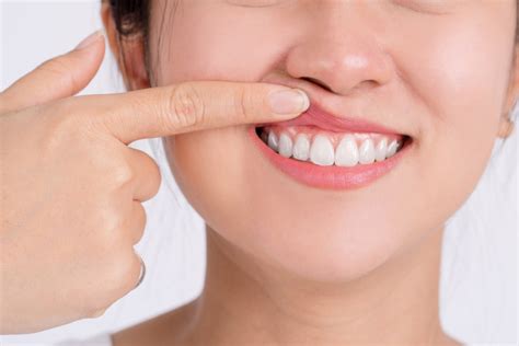 En qué consiste el mantenimiento periodontal Clínica Dental Félix