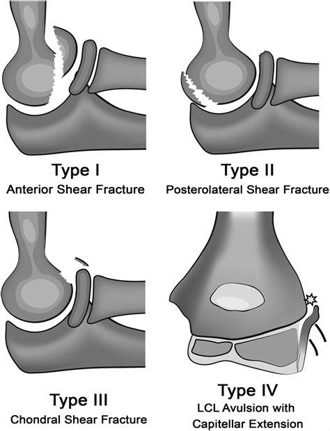 Journal of Pediatric Orthopaedics