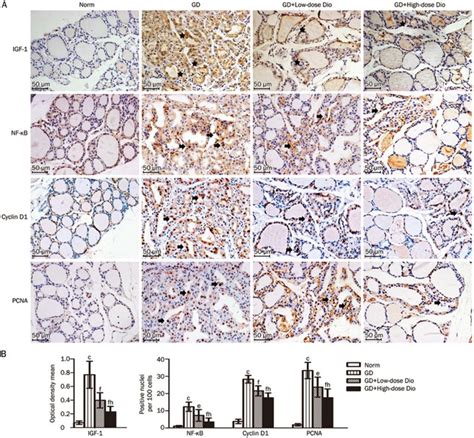 Immunohistochemical staining of IGF 1 NF κB cyclin D1 and PCNA in