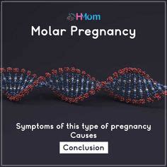 160 Best Molar Pregnancy ideas | pregnancy, molar pregnancy, new baby