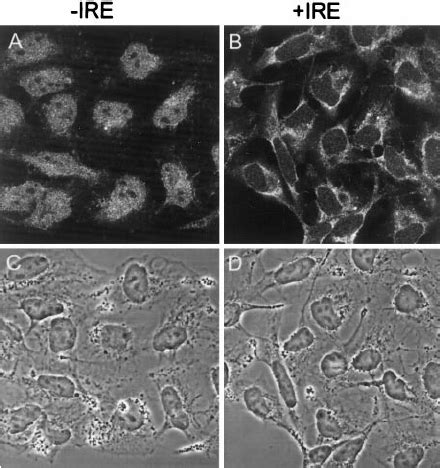 Confocal Fluorescent Micrographs Of Human Medulloblastoma Cells