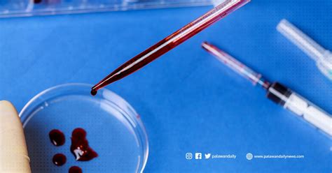 HIV Cases Rise Among Filipino Males With Same Sex Contact