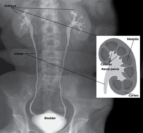 Anatomy Abdomen And Pelvis Ureter Statpearls Ncbi Bookshelf