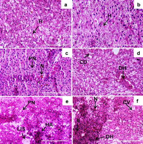 Histomaps of hepatic tissue. a Normal histology of hepatic ...