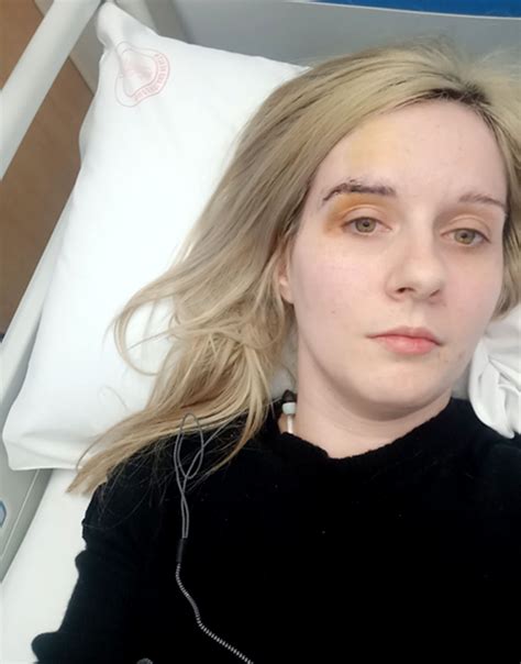 My Boob Job Turned Me Into A Real Life Zombie That S Life