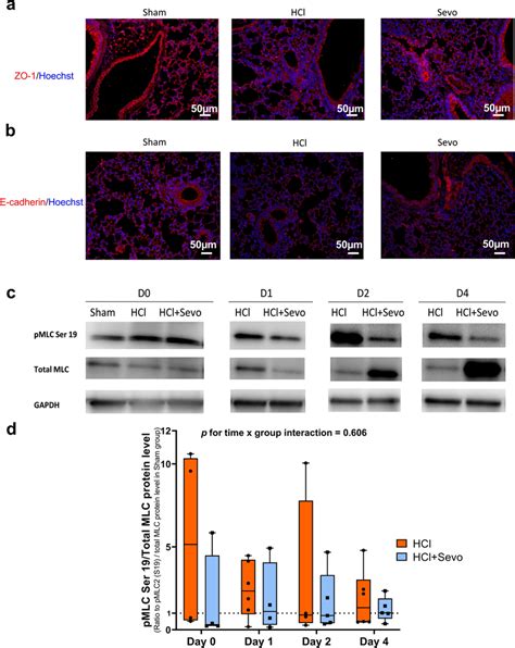 Lung Junction Proteins Zonula Occludens Zo And E Cadherin And Lung