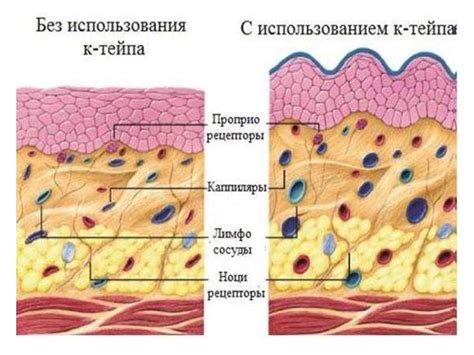 Кинезиологическое тейпирование - online presentation