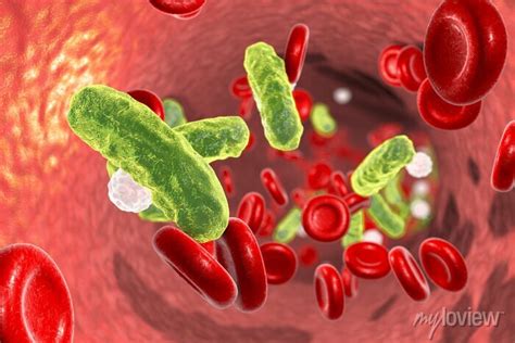 Bacteria No Sangue É Grave - Sepsis, bactérias no sangue. ilustração 3d mostrando bactérias ...