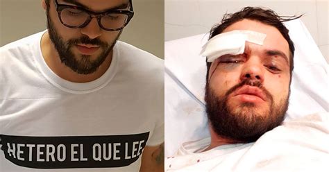 Los Vamos A Encontrar Van A Pagar Por Lo Que Le Hicieron Dijo Un Amigo Del Rugbier Gay Que