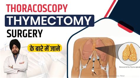 Thoracoscopy Thoracoscopic Thymectomy Surgery In Hindi Thymus Gland