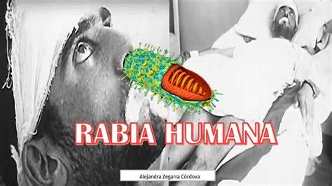 Rabia Humana Diapositivas Medicina Udocz