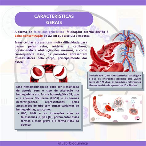 Caso Cl Nico De Anemia Falciforme Biologia Celular