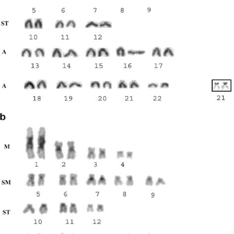 A Karyotype Of Porichthys Plectrodon Stained Conventionally With