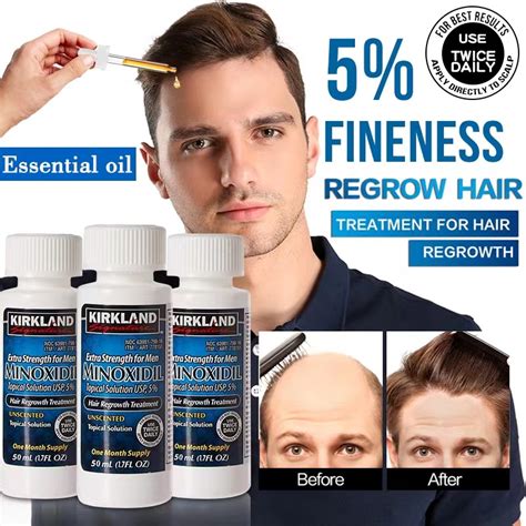 Kirkland Signature Hair Growth Treatment Extra Strength For Men