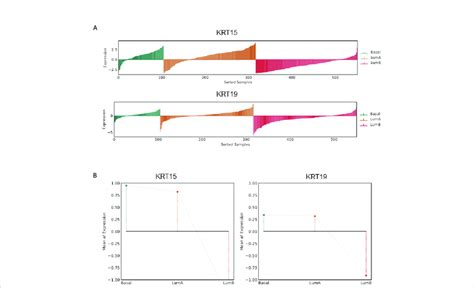 Association Of Krt And Krt Expression With Pca Subtypes In The Tcga