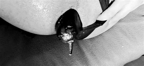 Ass Stuffed With Eggplant Gay Amateur Amateur Porn Feat My Deep Ass Xhamster