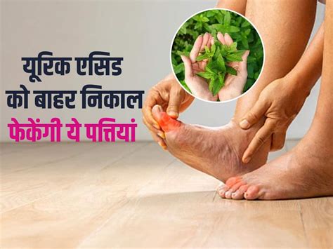 Uric Acid Control Karne Ka Tarika खून में जमा यूरिक एसिड के क्रिस्टल को पेशाब में चूर चूरकर