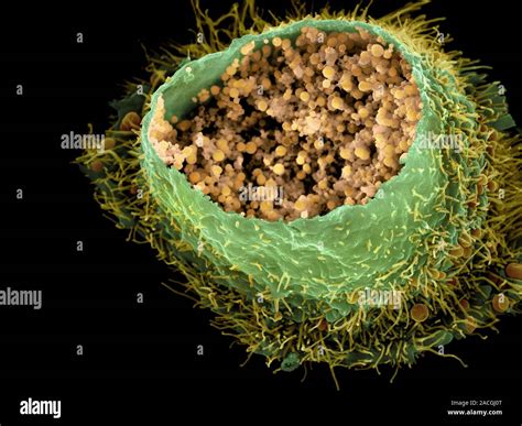 Chlamydia Infection Coloured Scanning Electron Micrograph Of A