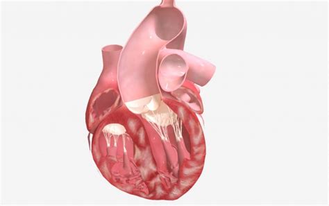 Restrictive Cardiomyopathy - Home