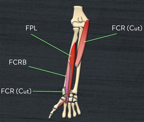 Funky Forearm Muscles – Bird Ultrasound