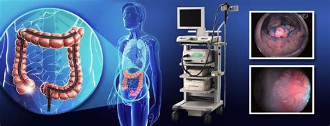 É Normal O Médico Pedir Biópsia Na Colonoscopia