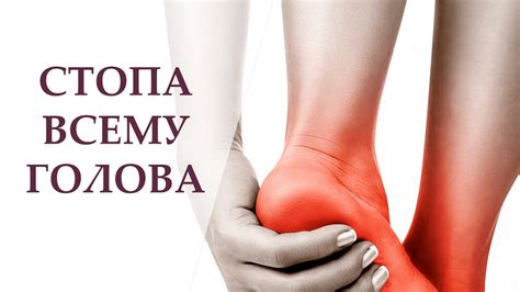 Убираем плоскостопие, вальгус (косточка на большом пальце стопы). - YouTube