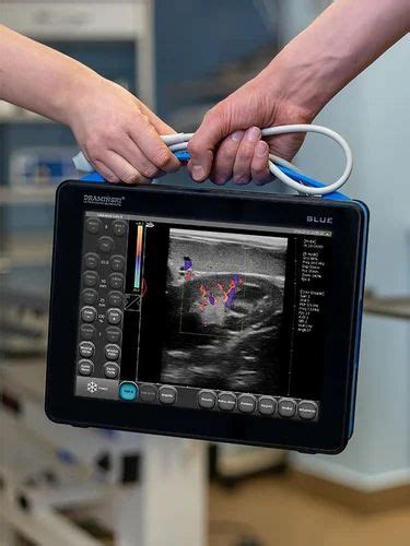 3D/4D Draminski Ultrasound Scanner Blue at Rs 1340000 in Bengaluru | ID ...