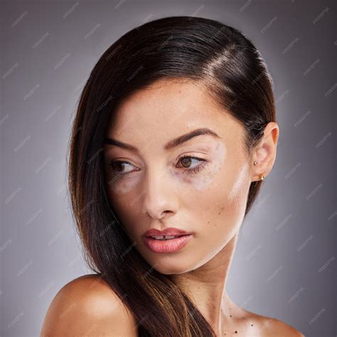 Rostro de belleza y vitíligo con una mujer modelo en estudio sobre un